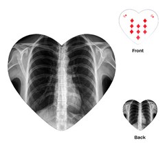 X Ray Playing Cards (heart)  by Valentinaart